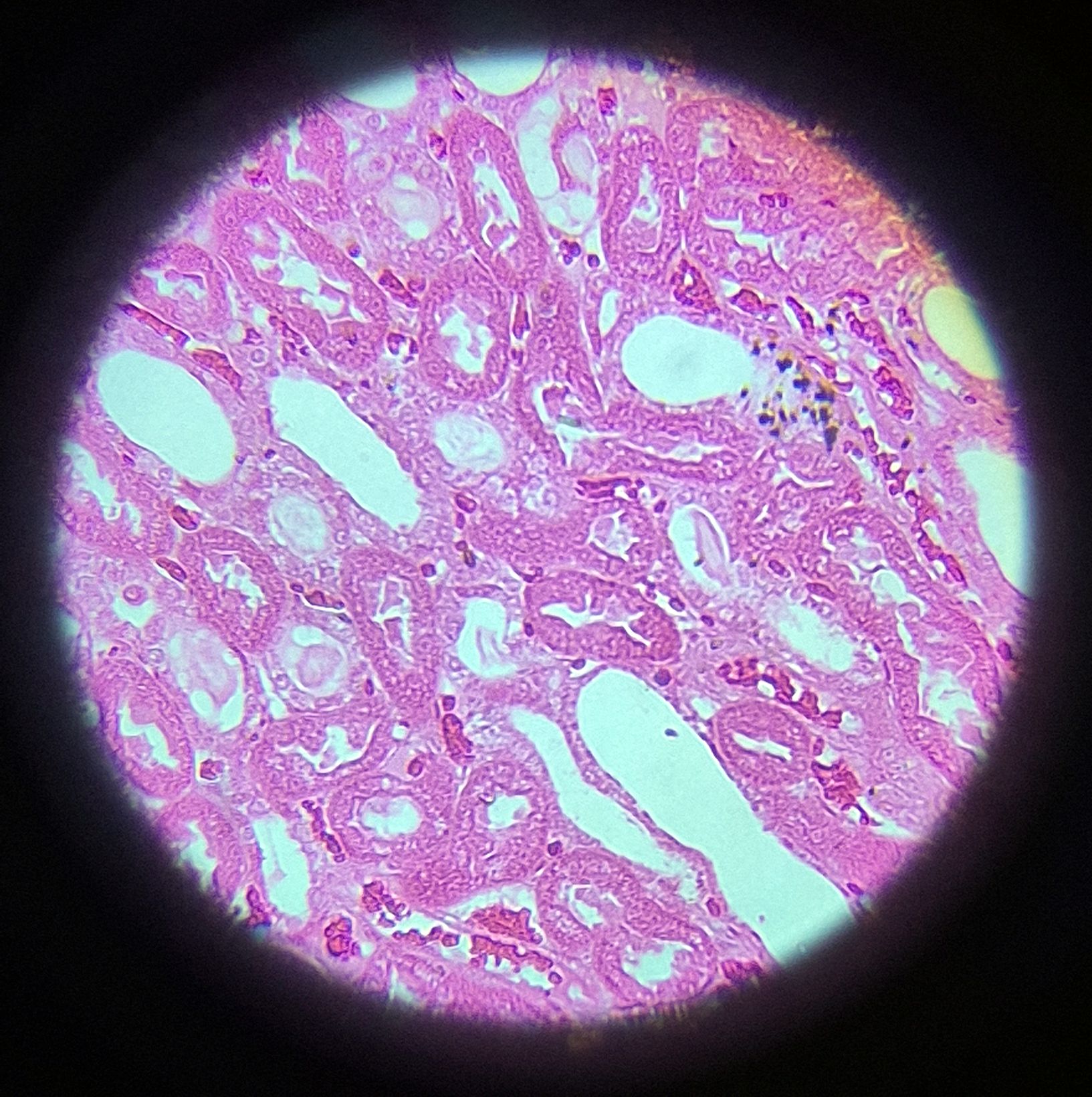 no-87-rein-l-s-kidney-of-l-s